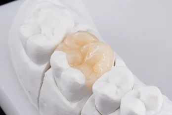 精密な被せ物の作成が可能に