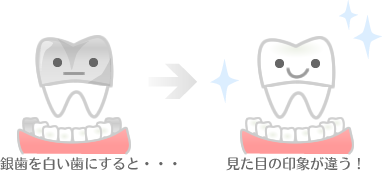 銀歯を白くしたい